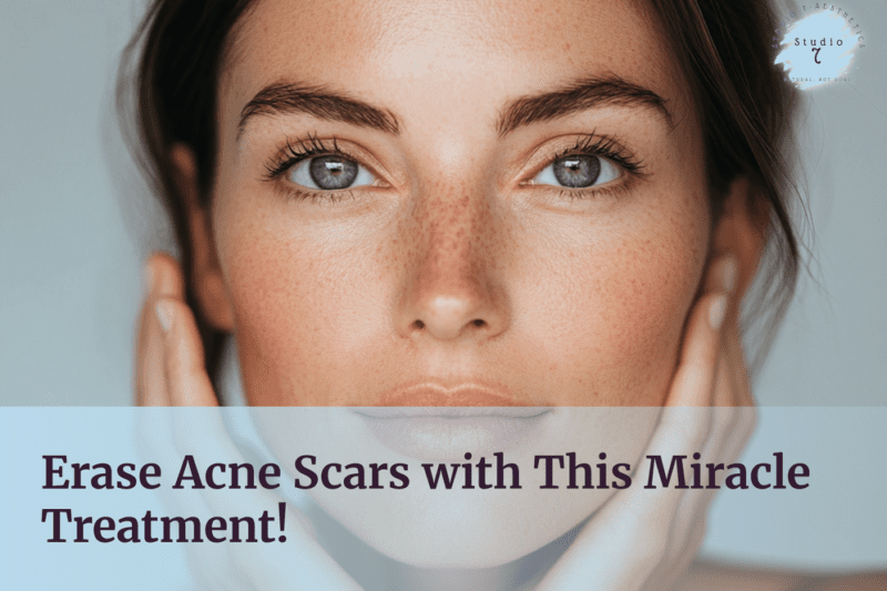 Woman with clear skin, acne treatment promotion.