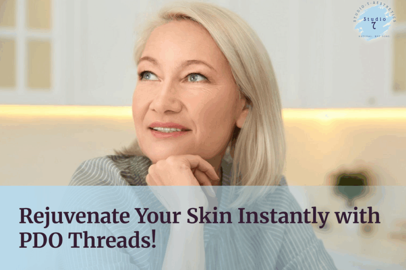 Woman smiling, promoting PDO threads treatment.