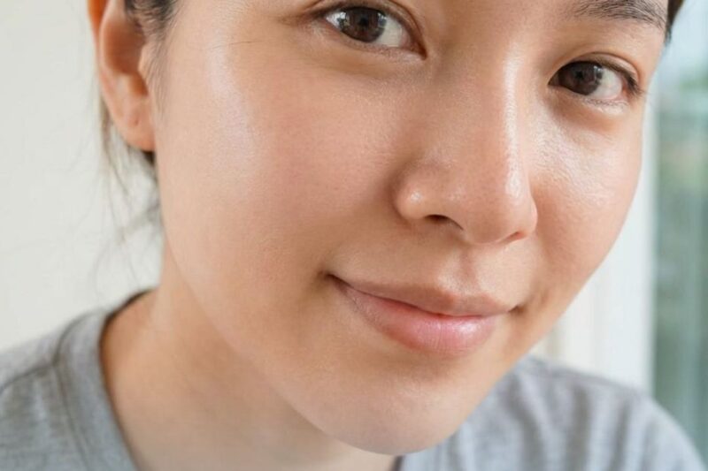Woman showcasing smooth skin after laser treatment.
