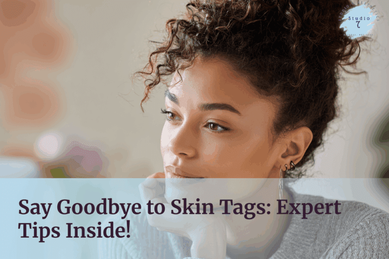 A woman with clear skin looks thoughtfully into the distance, promoting skin tag removal.
